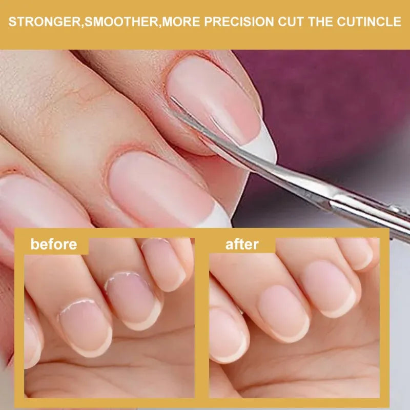 Cuticle dissolver-2